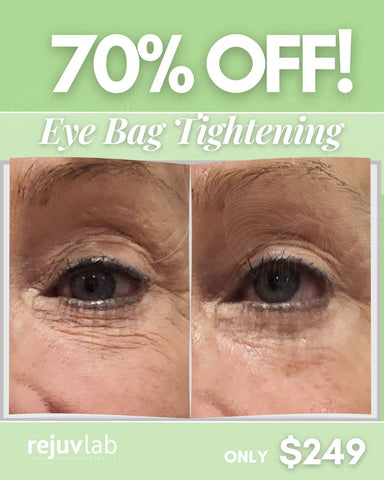 Under Eye Bag Reduction - No Needles Dotless Plasma
