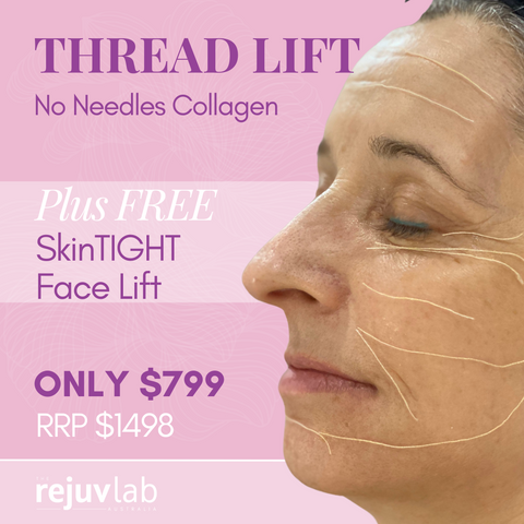 No Needles Collagen Thread Lift - with FREE SkinTIGHT Face Lift