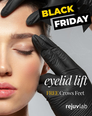 BLACK FRIDAY SALE: Eyelid Lift plus FREE Crows Feet