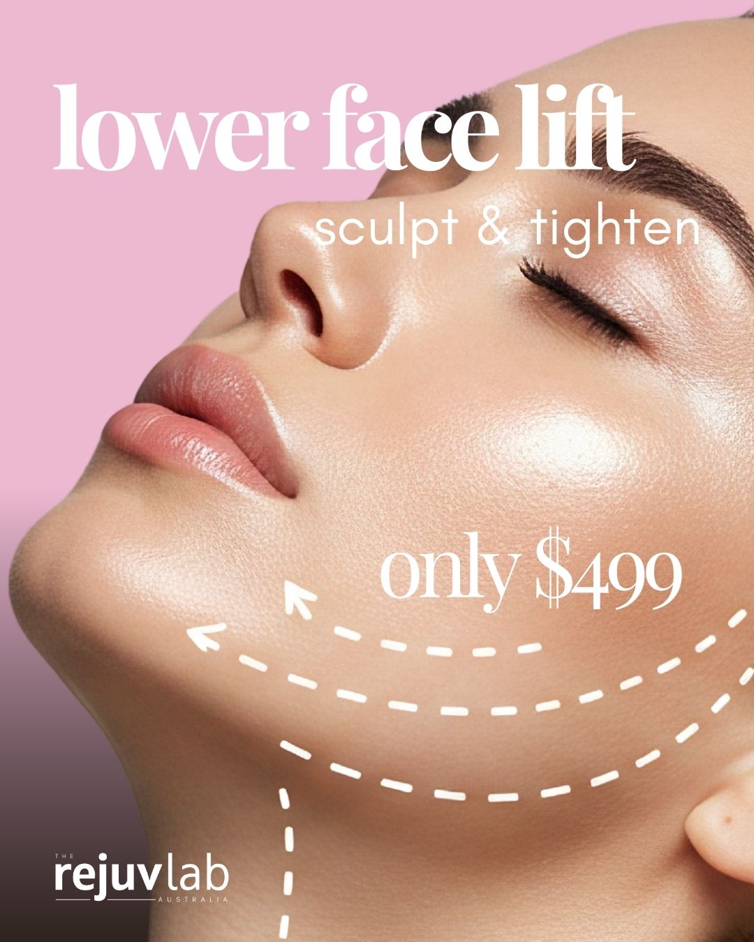 Lower Face Lift & Jawline Sculpting