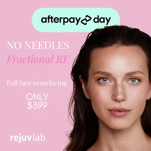 AFTERPAY DAY SALE:  No Needles Fractional RF