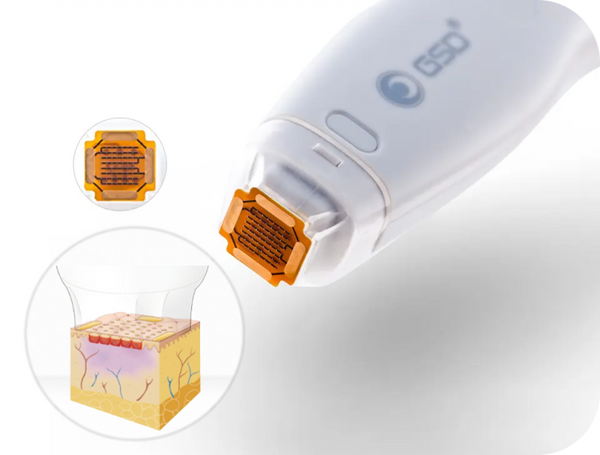 Fractional Rf Face No Needles Fractional RF | The Rejuv Lab