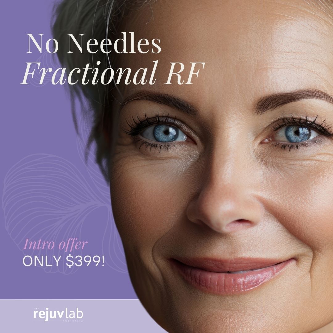 INTRO OFFER: NO NEEDLES FRACTIONAL RF SAVE $500