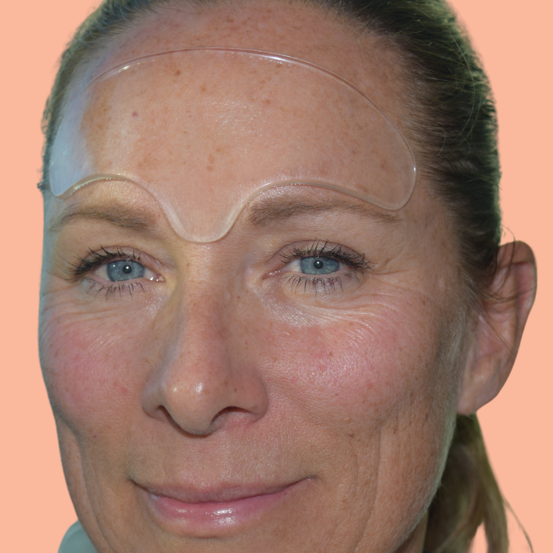 Forehead & Frown Lines Mask